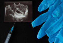 Ultrasound image syringe and blue gloves on black background