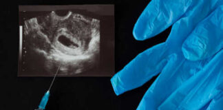 Ultrasound image syringe and blue gloves on black background