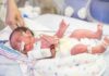 Killer Infant Disease Caught Without X-Rays Premature newborn in NICU with monitoring tubes