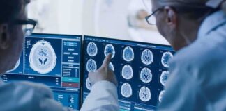 Doctors reviewing brain MRI scans on multiple monitors
